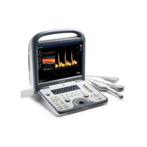 SonoScape S6 portable echo