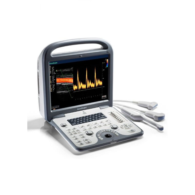 SonoScape S6 portable echo